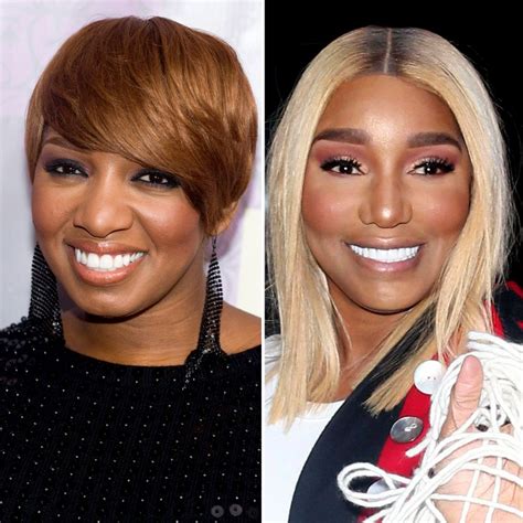 nene leaks before surgery|NeNe Leakes Plastic Surgery Before And After Photos